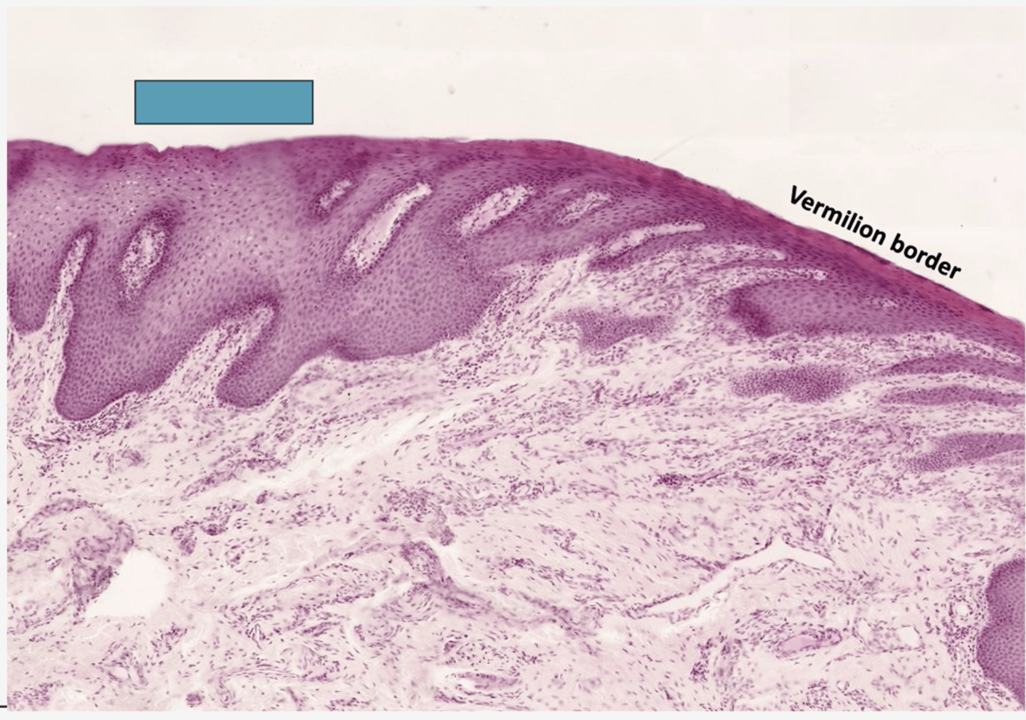 <p>Identify the mucosa</p>