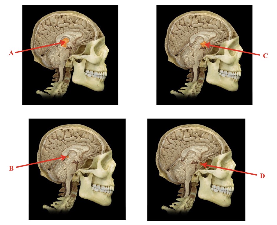 <p>B</p>