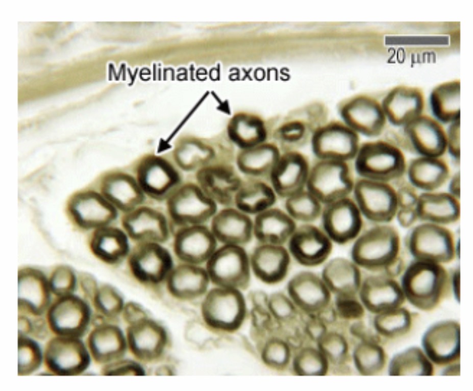 <p>Myeline sheath : Function : Insulates the axon and increases the speed of nerve impulse conduction.</p>