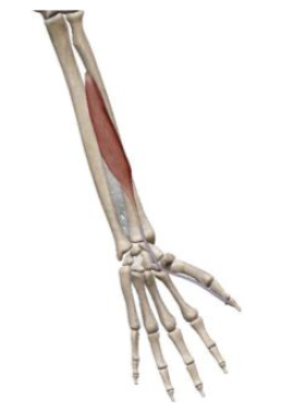 <p>what muscle and action is this </p>