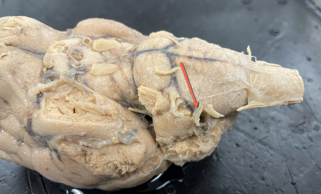 <p><span>Identify the cranial nerve indicated by the pointer.</span></p>