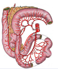 <p>-the ileum has mesenteric and anti-mesenteric blood vessels on both sides</p><p>-it has short mesentery and the ileocecal fold</p>