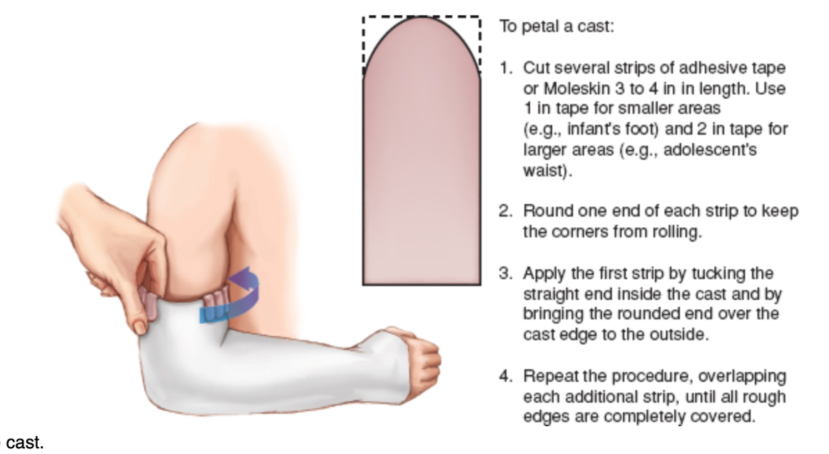 <p>line edges with moleskin or plastic line perianal to prevent skin damage </p>