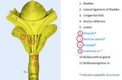 <p>Ampulla</p><p>Seminal vesicle</p><p>Prostate</p><p>Urethralis M</p>