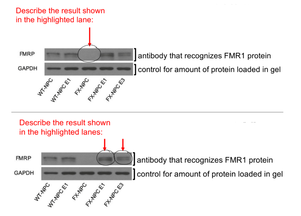 <p><u>for the CRISPR-Cas9 approach to reverse silencing of FMR1 gene in FXS: w/ </u><span style="color: rgb(199, 196, 196);"><u>living</u></span><u> Cas9</u></p><p>DNA is <u>very/abnormally </u><strong><u>HIGHLY </u></strong>methylated in __ __ cells from __ patients, while DNA has low methylation in __/__ patients</p><p>these __ __ cells are treated w/ CRISPR-Cas9 to target the CGG repeats, to get:</p><ul><li><p>(1 ← 1) cells that show NO change in DNA methylation patterns</p></li><li><p>(1 ← 2) cells show DECREASE in DNA methylation compared to FXS NPC cells, where DNA methylation is <u>reduced to NORMAL WILDTYPE levels</u> in these cells</p></li></ul><p>__</p><p>answer 2Qs in the pic, explain</p><p>conclusion (1)</p>