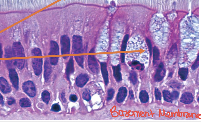 <p>What kind of tissue is this?</p>