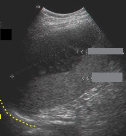 <p>Identify this image.</p>