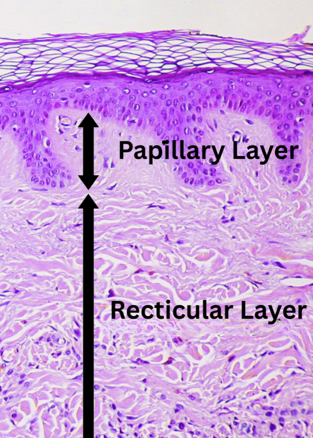 <p>reticular layer</p>