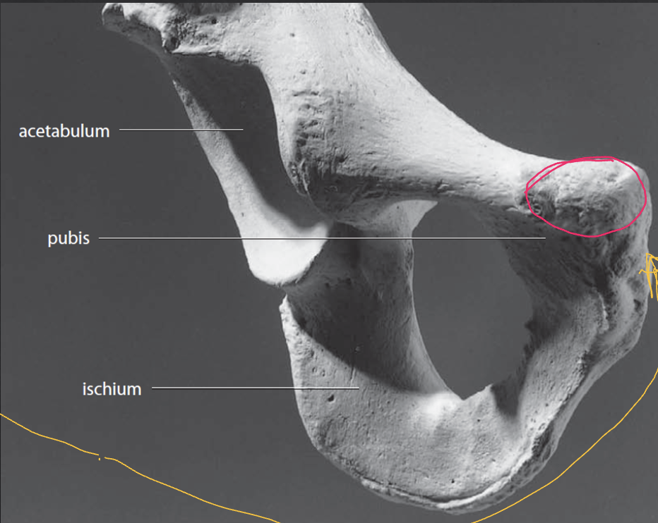 <p>Pelvis: What is the Yellow?</p>