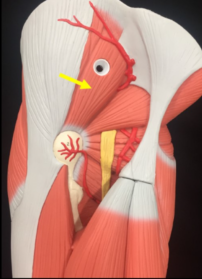 <p>Name the muscle</p>