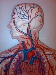 <p>What artery is the arrow pointing too?</p>