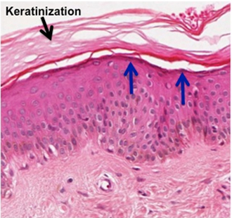 <p>Found in skin</p>