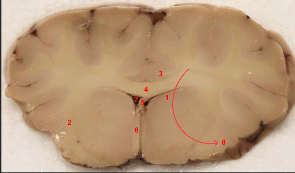 <p>what cortex is this </p>