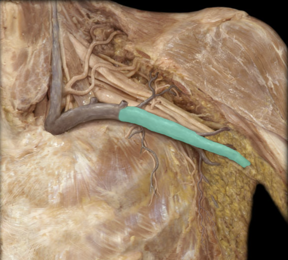 <p>Identify the blood vessel of the upper extremity</p>