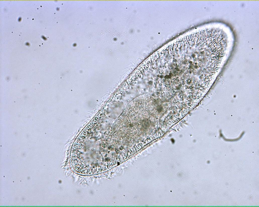 <ol><li><p>is this a protist or a bacteria?</p></li><li><p>what phylum?</p></li><li><p>what are the hair like structures?</p></li></ol><p></p>