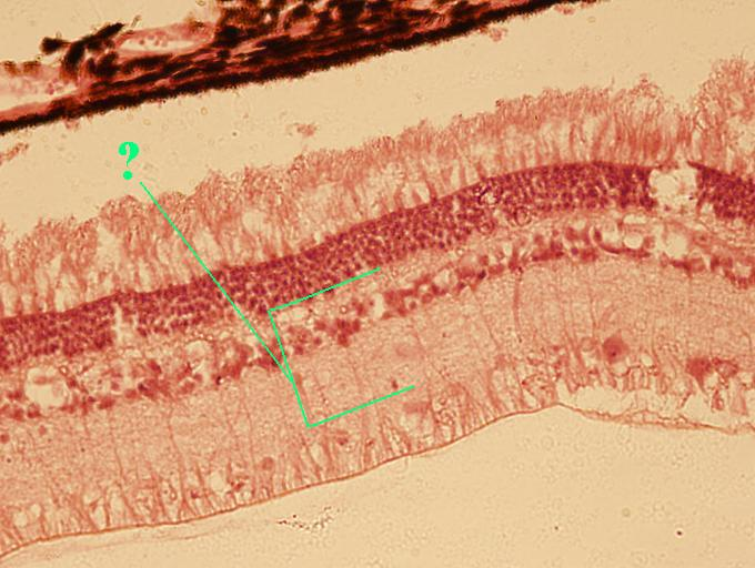 <p>Identify the indicated layer of the retina</p>