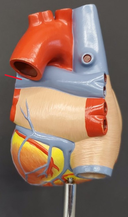 <p>Name the artery</p>