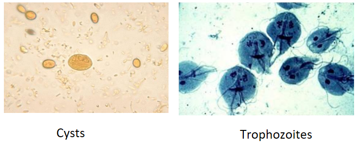 <p>Describe the <strong>Source </strong>of this waterborne protozoan:</p><p>-<strong>Giardia duodenalis</strong></p>