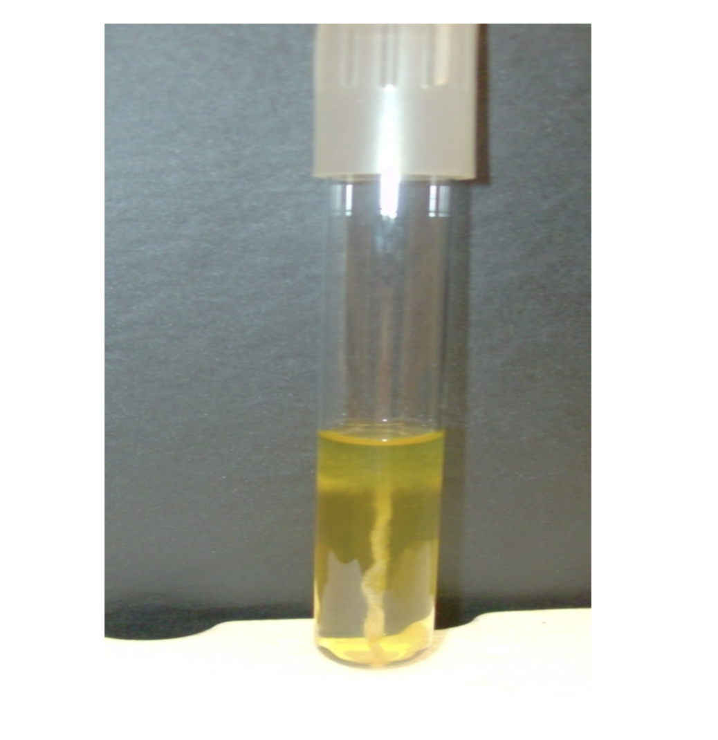 <p>what is the test and result?</p>