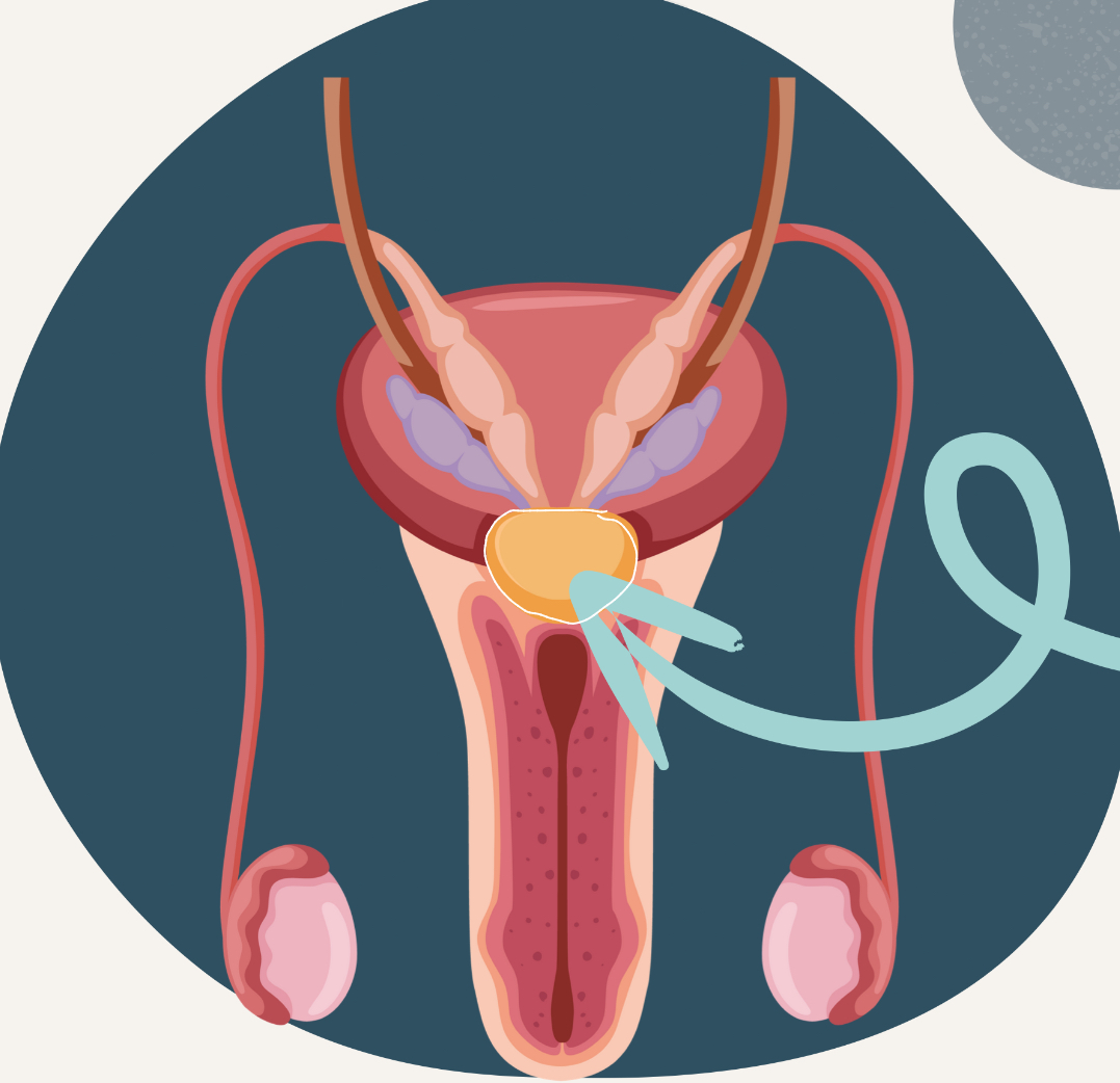 <p>walnut-sized gland located between the bladder and the penis</p><ul><li><p>secretes fluid that nourishes and protects the sperm</p></li><li><p>milky white color and is <strong>alkaline</strong> to help balance out the acidic environment of female vagina</p></li></ul><p></p>