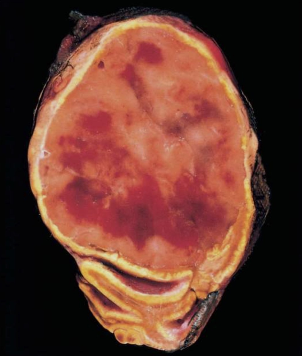 term image