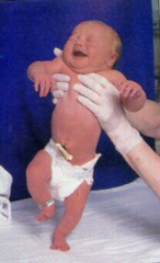 <p>An infant reflex in which the infant steps up and down when held upright</p>