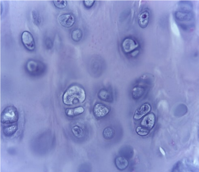 <p>Hyaline Cartilage</p>