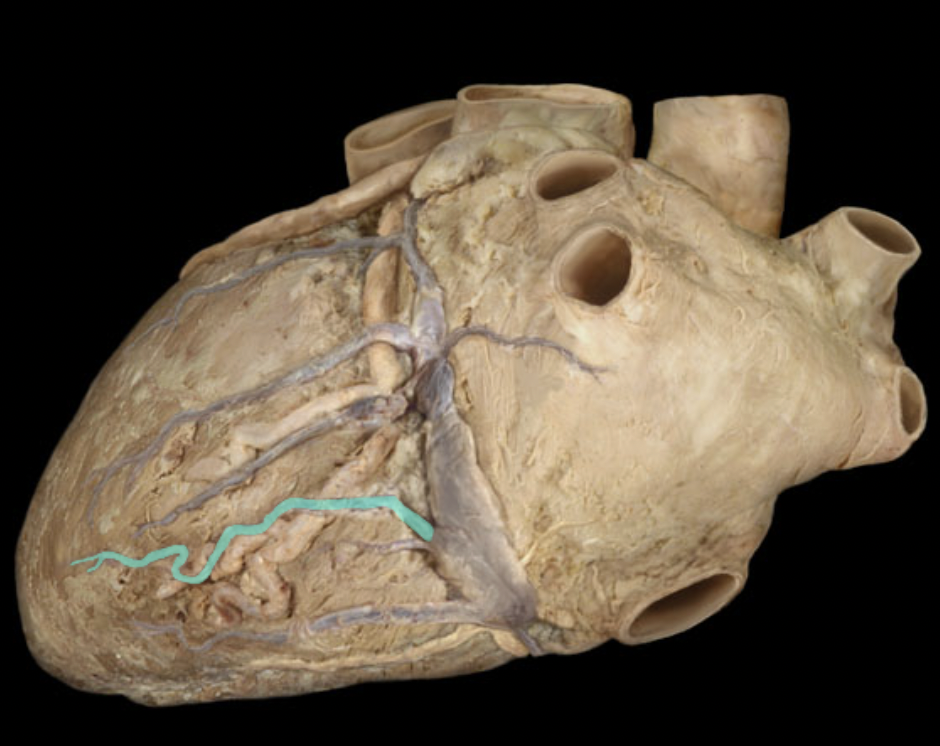 <p>Identify the coronary vein</p>