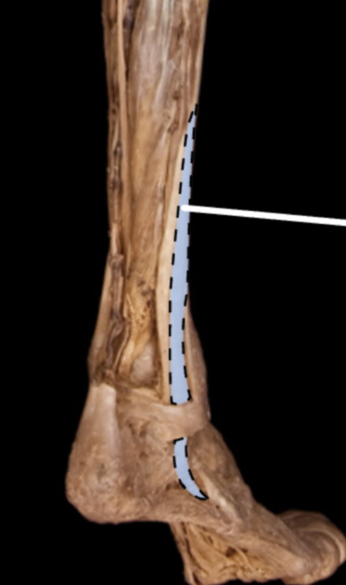 <p>Origin: Posterior surface of the tibia</p><p>Insertion: Base of the distal phalanges of the 2nd-5th toes</p><p>Action:</p><ul><li><p>Flexion of the lateral four digits</p></li><li><p>Plantarflexion and inversion of the ankle</p></li></ul><p>Innervation: Tibial Nerve</p>