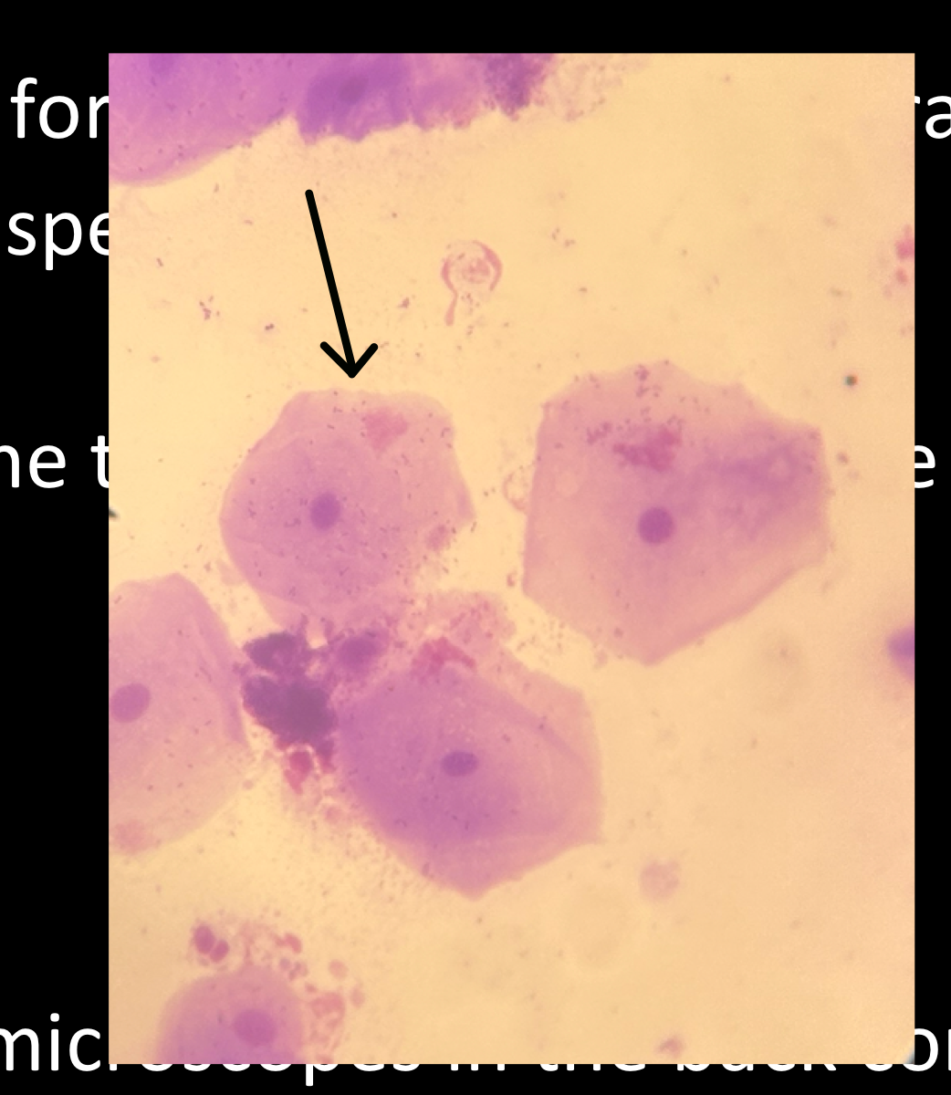 <p>In this Purple stain Human cell what is this</p>