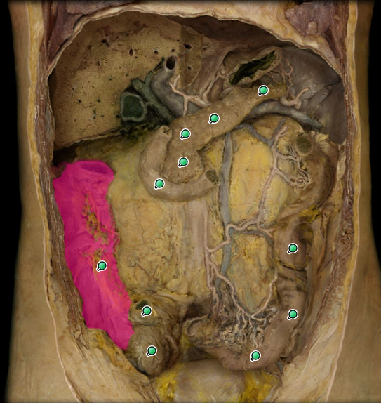 <p>What organ is this?</p>