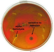 <p>What type of hemolysis means the <strong>partial destruction</strong> of RBC’s (red blood cells) and appears translucent? (example: <em>Streptococcus pneumoniae</em>)</p>