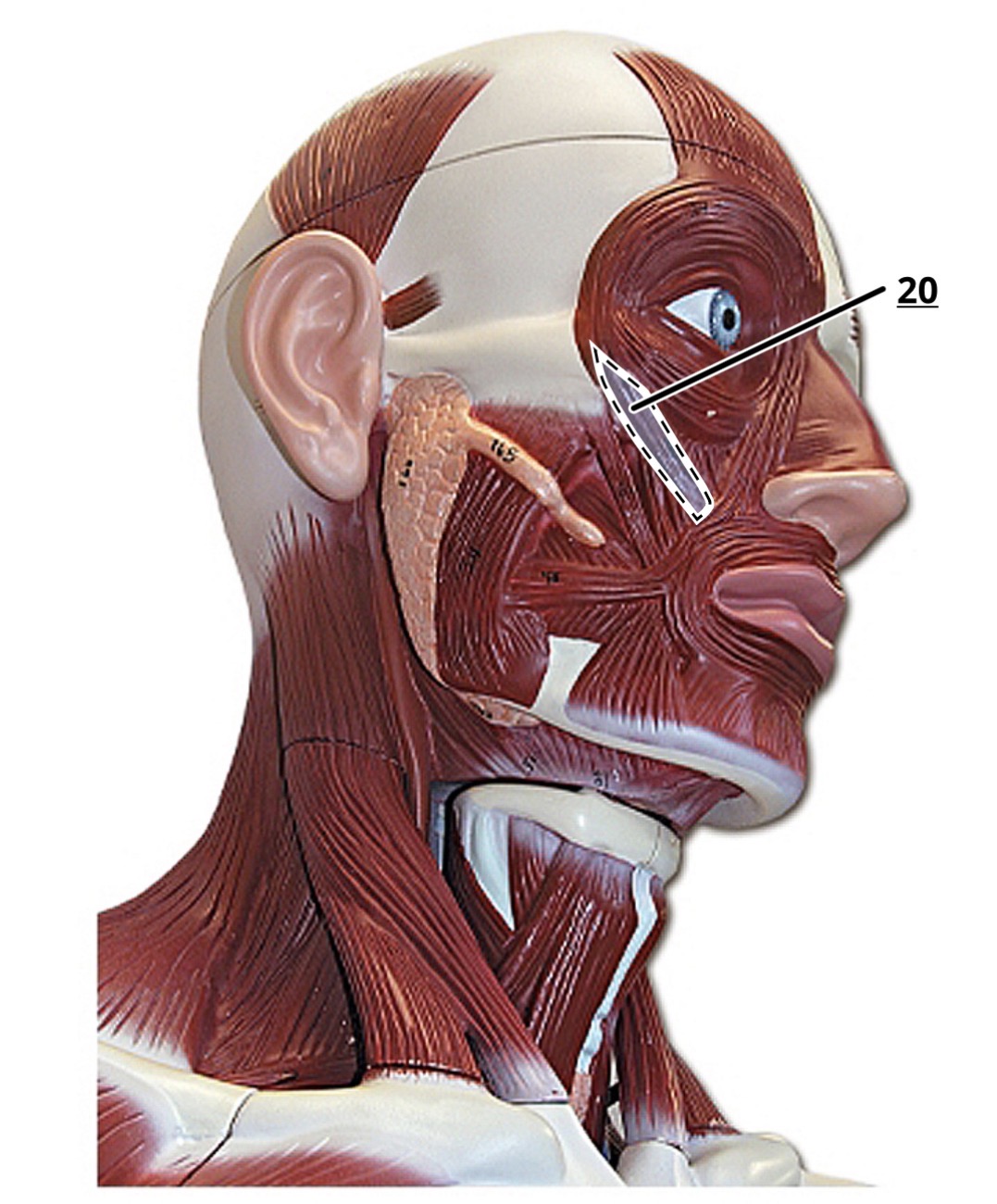 term image
