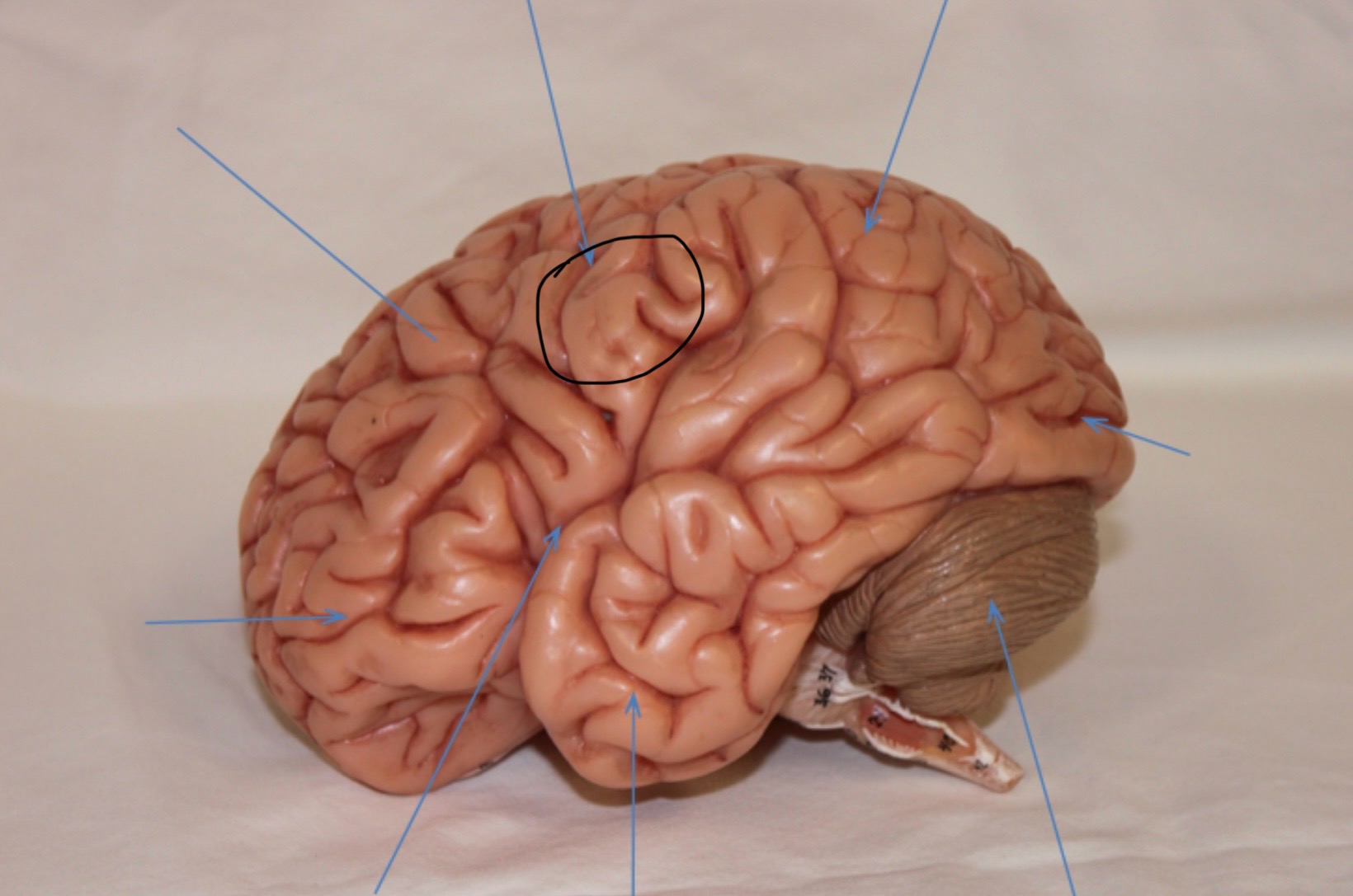 <p>Identify the circled area?</p>