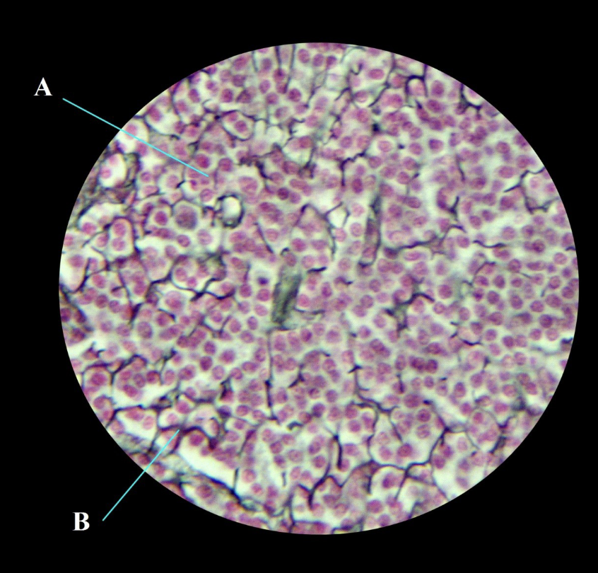 <p>What is this, where is it found, what is A, what is B</p>