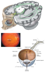 <p>What nerve carries the visual signal from the retina to the visual cortex?</p>
