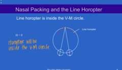 <p>When the line horopter is INSIDE the V-M circle, there will be (temporal/nasal) packing?</p>