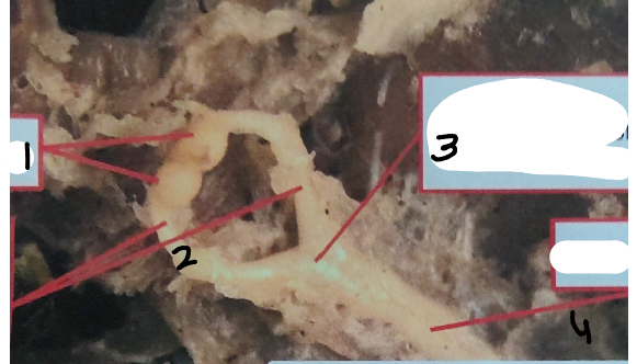 <p>What is point 4 on this earthworm </p>