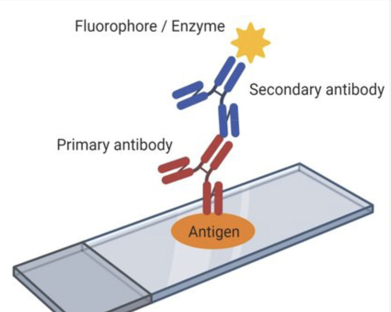 <p>Indirect immunofluorescence</p>