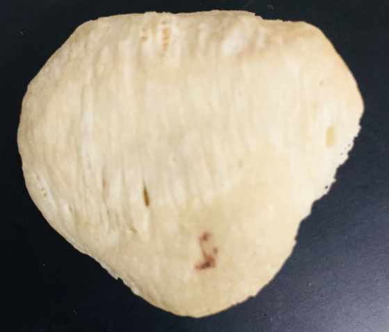 <p>name bone</p>