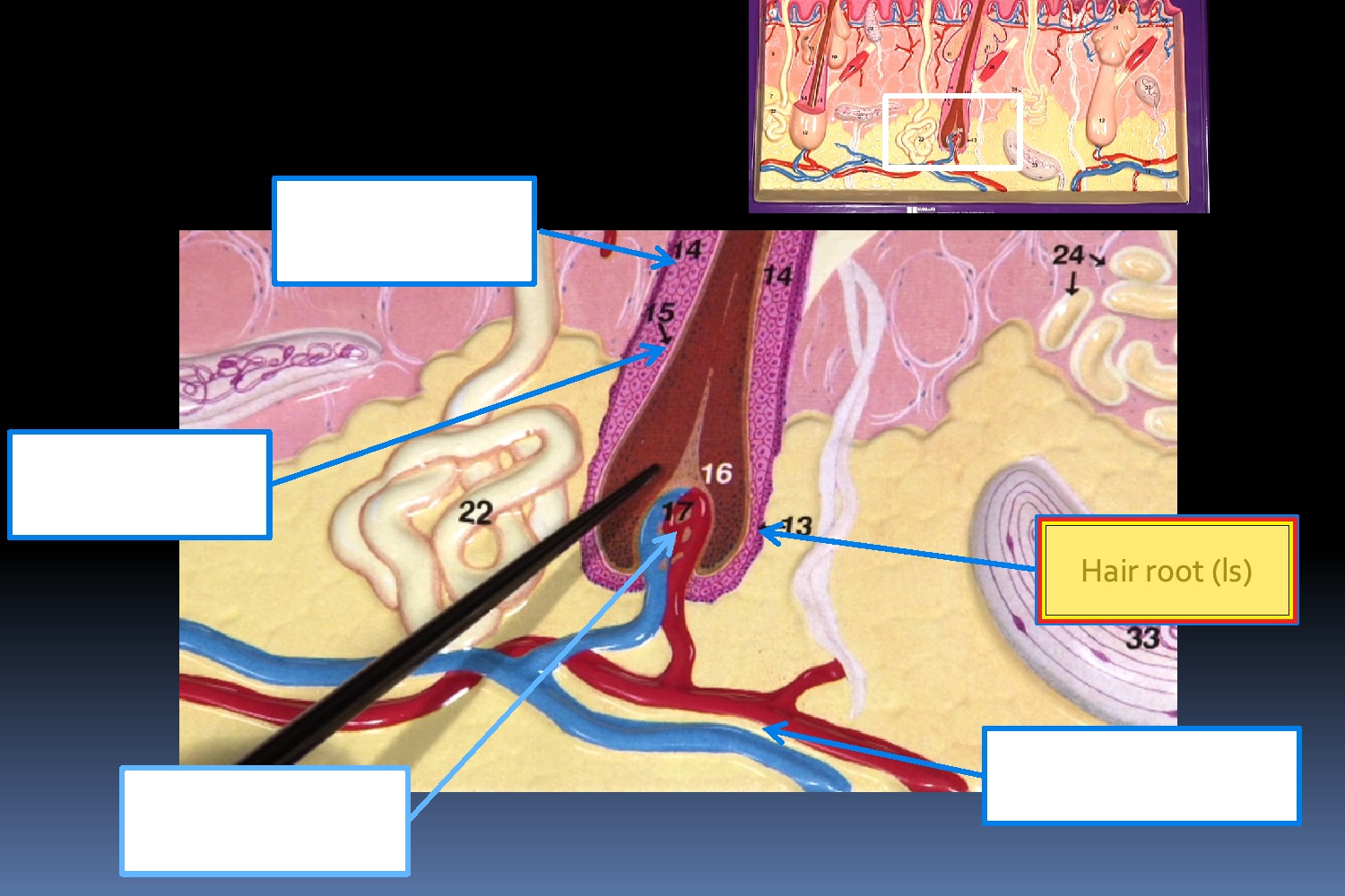 <p>Structure: Hair Root (LS)</p>