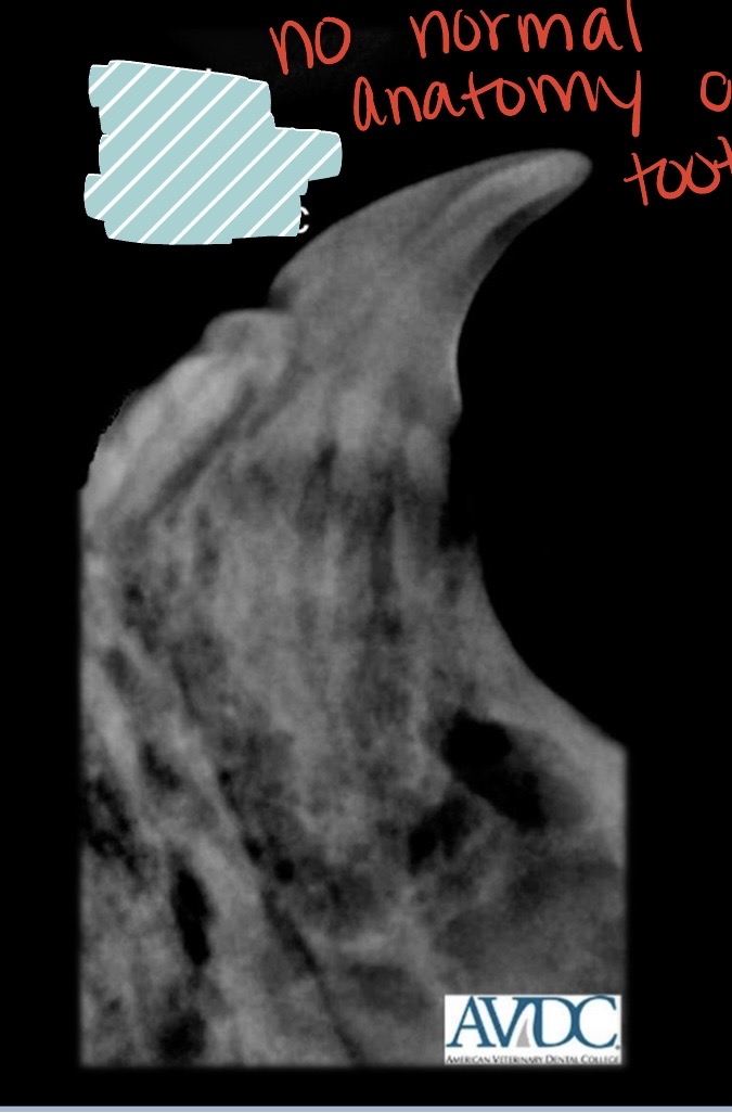 <p>what stage of tooth resorption is this?</p>