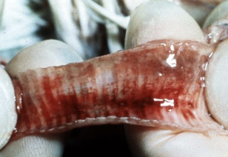 <p>Trachea of a chicken. Which is the correct morphological diagnosis? </p>