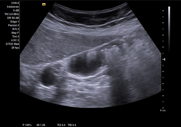 <p>List findings and suspected diagnosis</p>