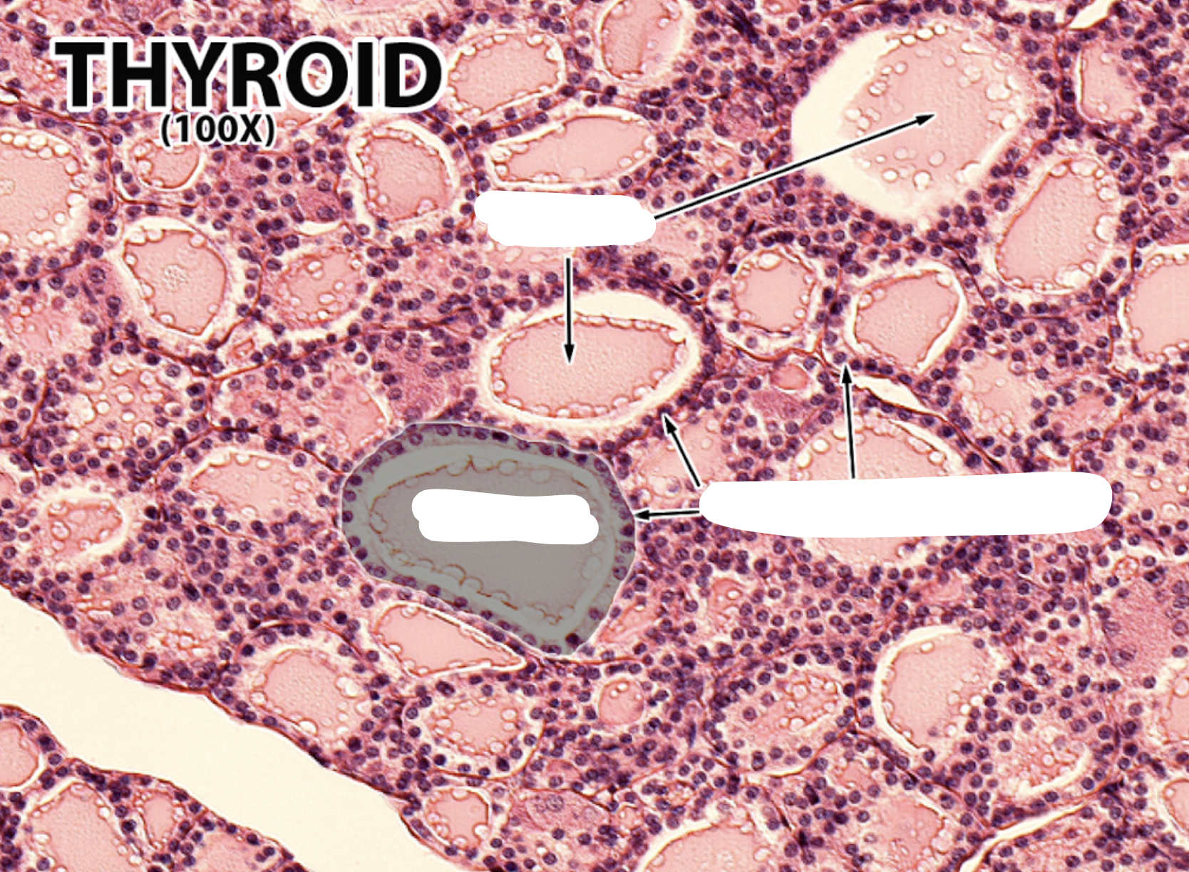 <p>Label the follicles and its components </p>