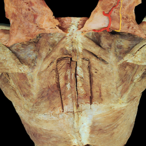 <p>what are the highlight nerve and artery</p>