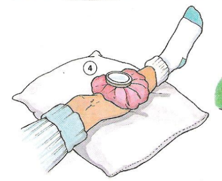 <p>ice pack </p>