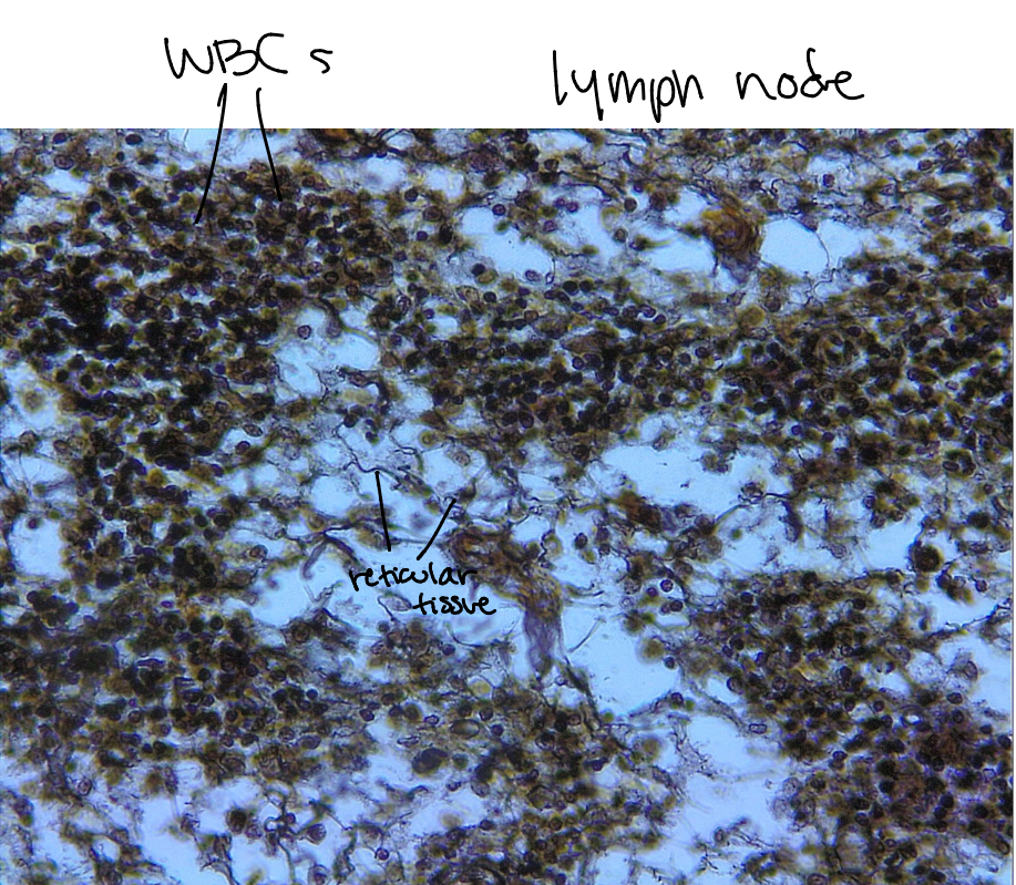 <p>Loose reticular. Network of reticular (still collagenous) fibers that form a soft internal skeleton that supports other cell types, such as white blood cells, macrophages, and mast cells. Building like framework allows wbcs to move around and leave when needed. Found in lymphoid organs such as lymph nodes, bone marrow, and the spleen.</p>