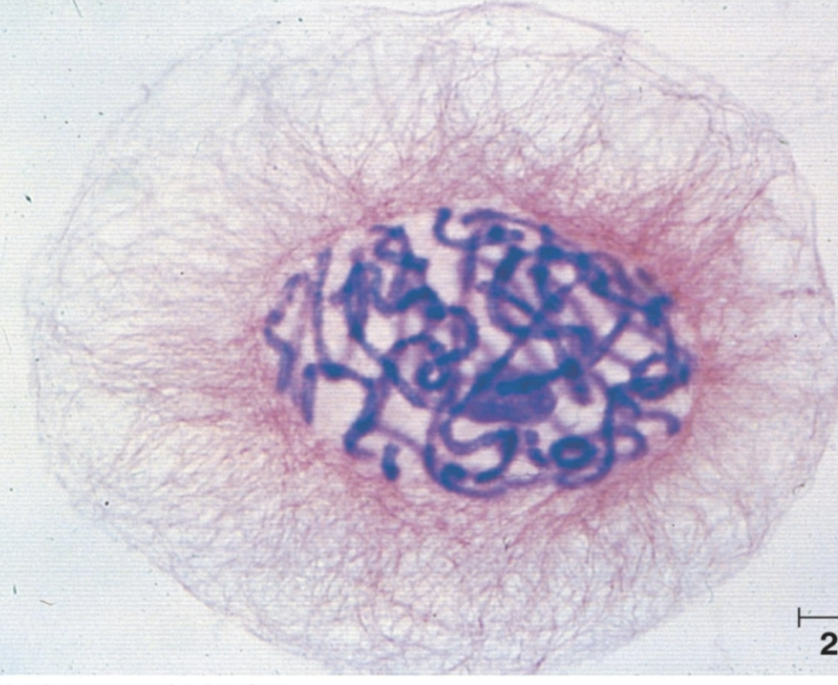 <ul><li><p><span style="background-color: transparent;">Chromosomes turn <strong>thick &amp; visible&nbsp;</strong></span></p></li><li><p><span style="background-color: transparent;"><strong>Mitotic spindle fibers form</strong></span></p></li><li><p><span style="background-color: transparent;">Nucleolus <strong>disappears</strong>&nbsp;</span></p></li><li><p><span style="background-color: transparent;">Nuclear envelope breaks down&nbsp;</span><span data-name="love_letter" data-type="emoji">💌</span><span data-name="broken_heart" data-type="emoji">💔</span></p></li></ul><p></p>