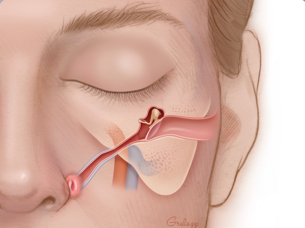<p>Eustachian Tube</p>